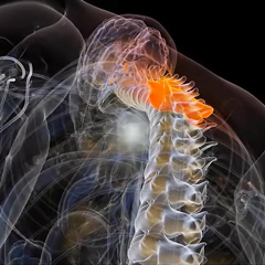 Treatment Delivery Systems